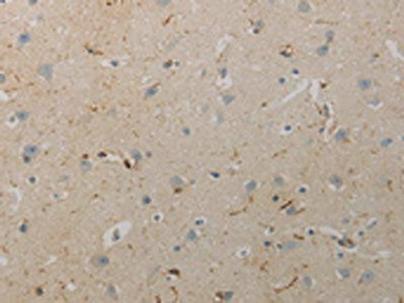 AATK Antibody (PACO17473)