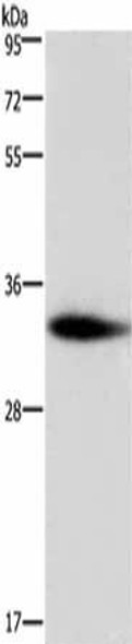 ADO Antibody (PACO17494)