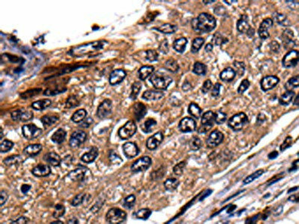 RAB41 Antibody (PACO17517)