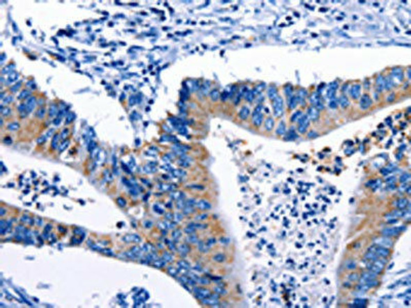 Gjc3 Antibody (PACO17742)