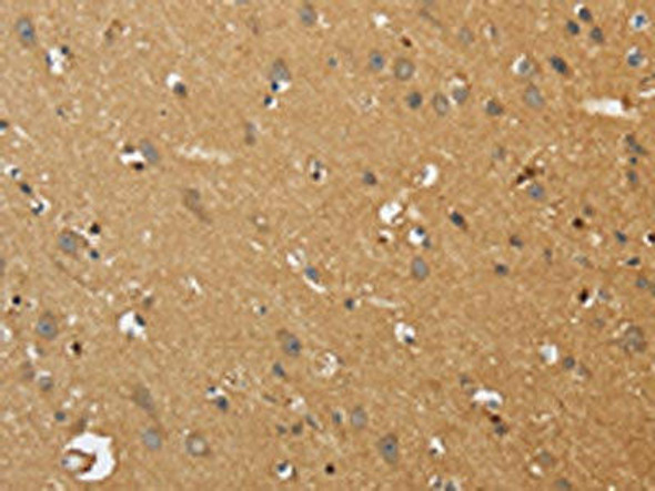 EDNRA Antibody (PACO17819)