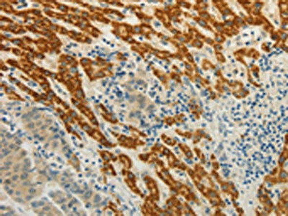 CMTM7 Antibody (PACO17940)