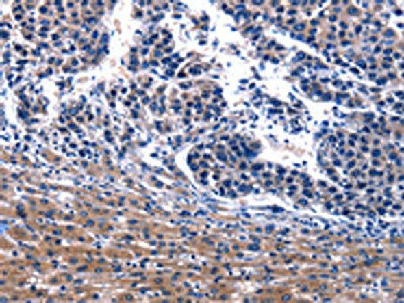 IRS4 Antibody (PACO18114)
