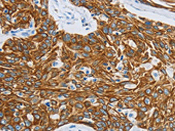MMP21 Antibody (PACO18229)