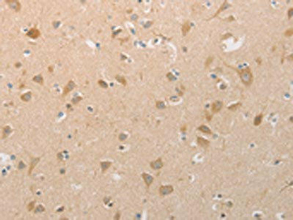 PGA3/PGA4/PGA5 Antibody (PACO18355)