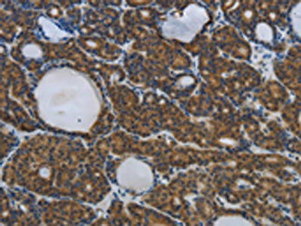 SPAG4 Antibody (PACO18427)