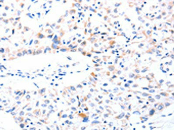 SPAG4 Antibody (PACO18428)