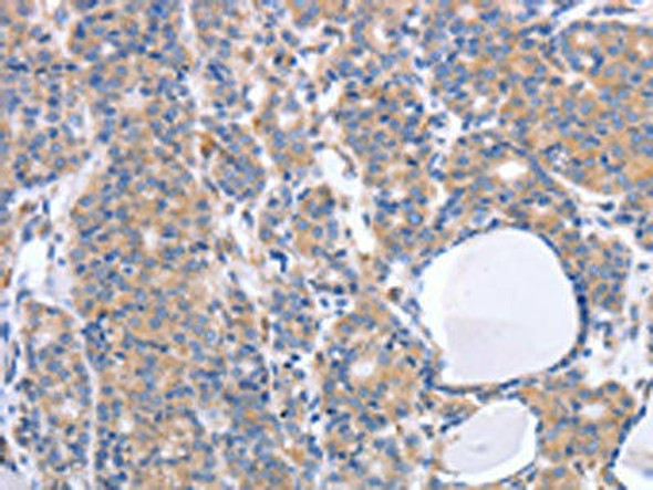 GFRA4 Antibody (PACO18432)