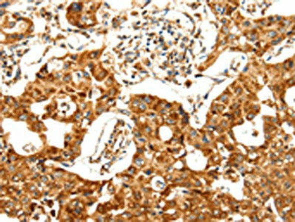DOPEY1 Antibody (PACO18484)