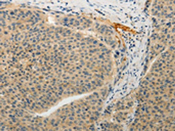 ADAMTS6 Antibody (PACO18517)