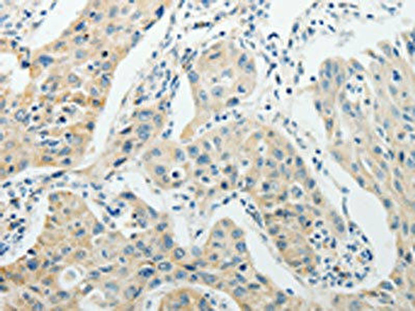 AGBL1 Antibody (PACO18528)