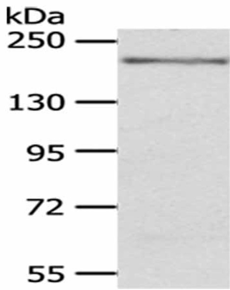 KDM6B Antibody (PACO18593)