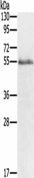GJA9 Antibody (PACO18601)