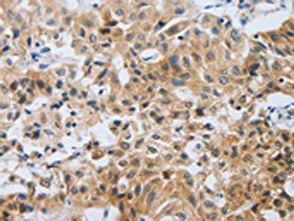 NEB Antibody (PACO18739)