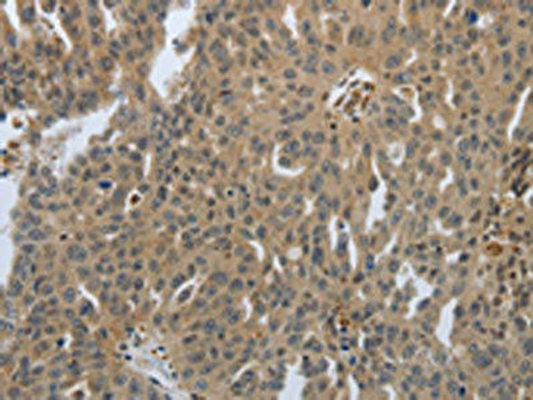 PTPRT Antibody (PACO18858)