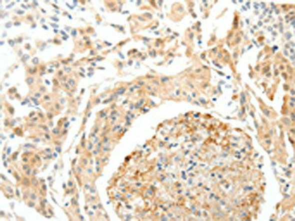 SEMA3D Antibody (PACO18887)