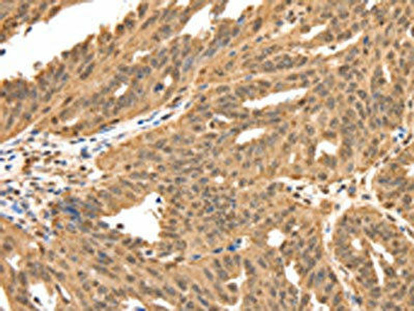 SPATA20 Antibody (PACO18920)