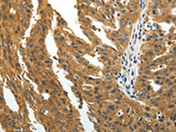 BIRC6 Antibody (PACO18942)