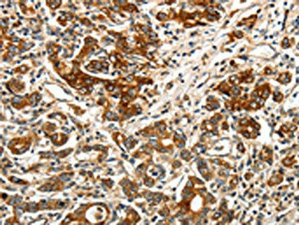 BIRC6 Antibody (PACO18943)