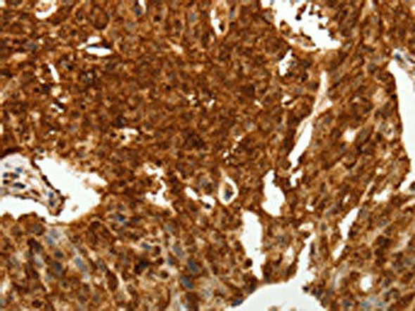 TENM3 Antibody (PACO18962)