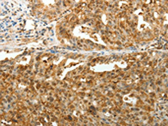 TENM3 Antibody (PACO18963)