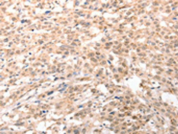 ACIN1 Antibody (PACO19042)