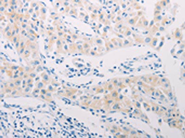 ADAMTS17 Antibody (PACO19062)