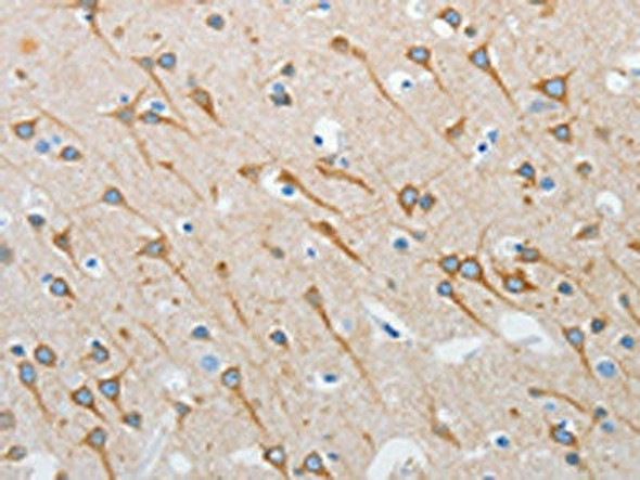 INTS1 Antibody (PACO19164)