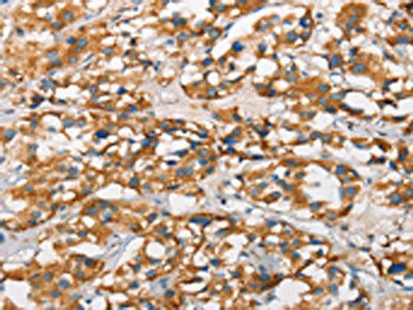 MARC1 Antibody (PACO19229)