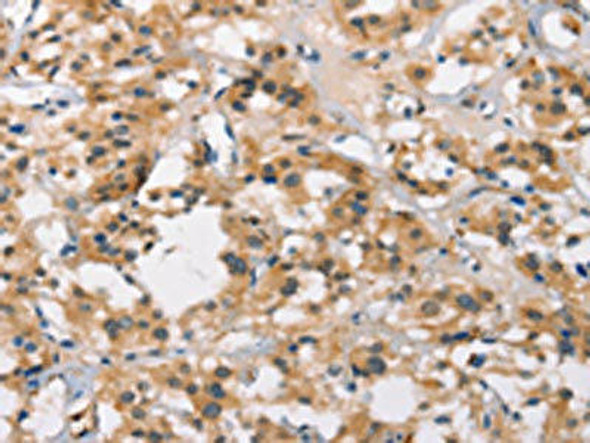 MARC1 Antibody (PACO19230)