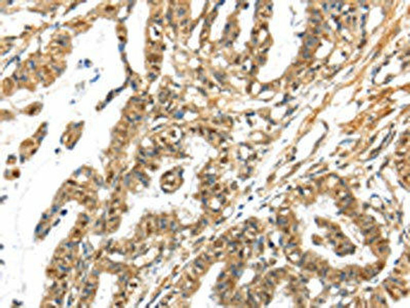 APOL6 Antibody (PACO19319)