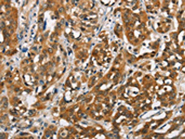 SH2B2 Antibody (PACO19320)