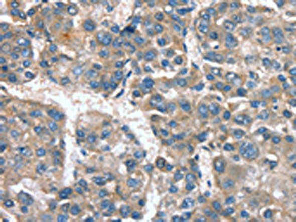 CACNA1G Antibody (PACO19378)
