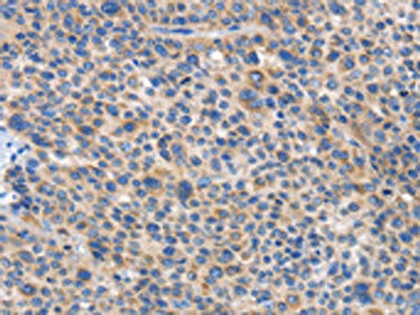 CARD17 Antibody (PACO19390)