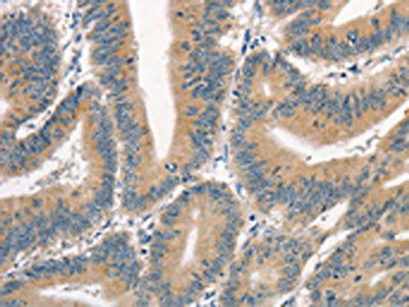 CRIM1 Antibody (PACO19511)