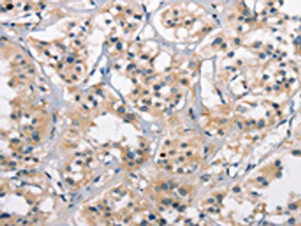 CTAG1A/CTAG1A Antibody (PACO19523)
