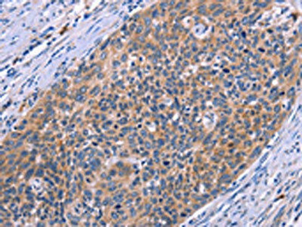 MSMO1 Antibody (PACO19615)