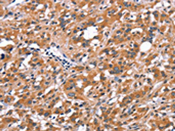 FDCSP Antibody (PACO19651)