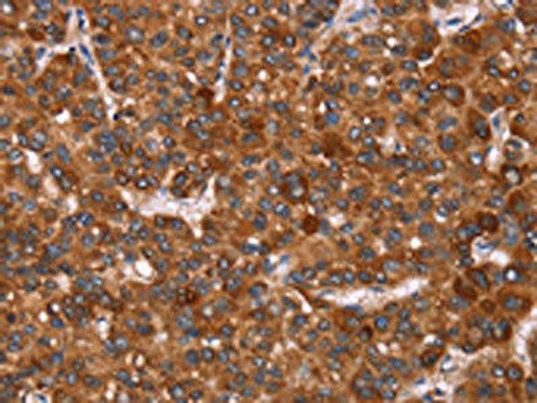 GAGE12I Antibody (PACO19689)