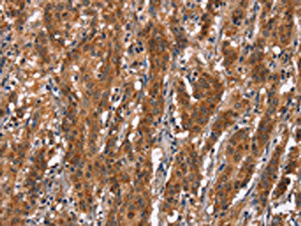 GPHN Antibody (PACO19700)