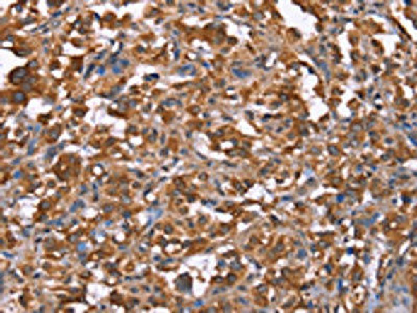 HRASLS2 Antibody (PACO19782)