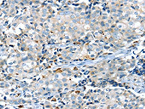KCNG3 Antibody (PACO19882)
