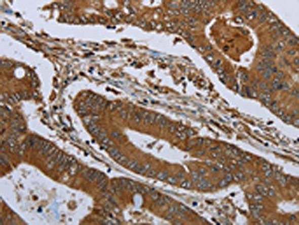 KLRF1 Antibody (PACO19914)