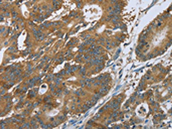 CERS4 Antibody (PACO19927)