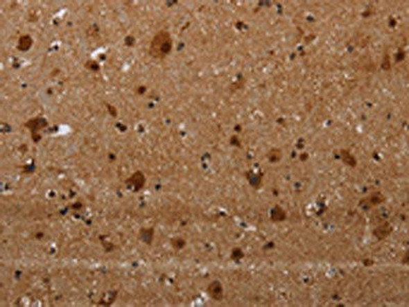 MAGEE1 Antibody (PACO19976)