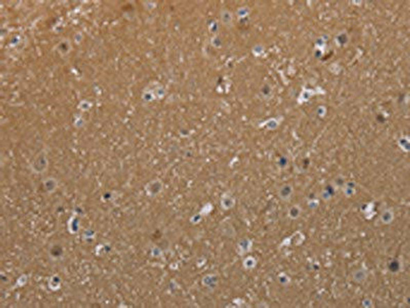 MAGEL2 Antibody (PACO19981)