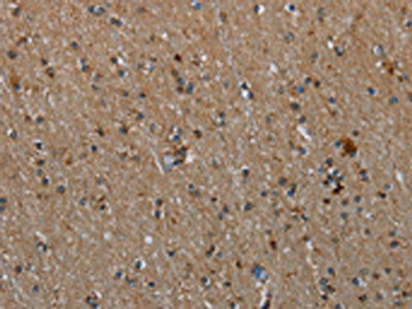 MMP23A Antibody (PACO20030)