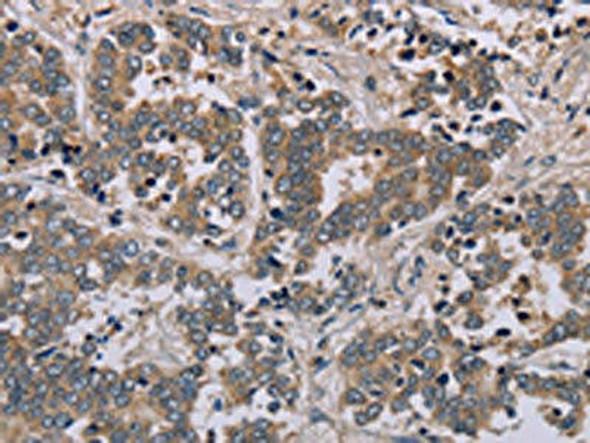 AATK Antibody (PACO20089)