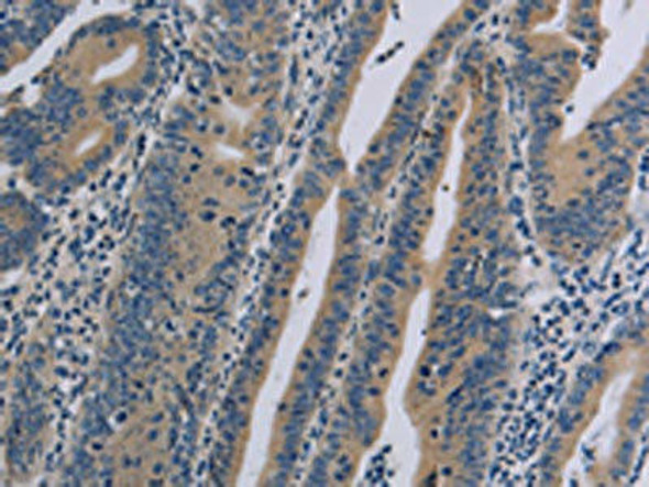 NLRP9 Antibody (PACO20106)