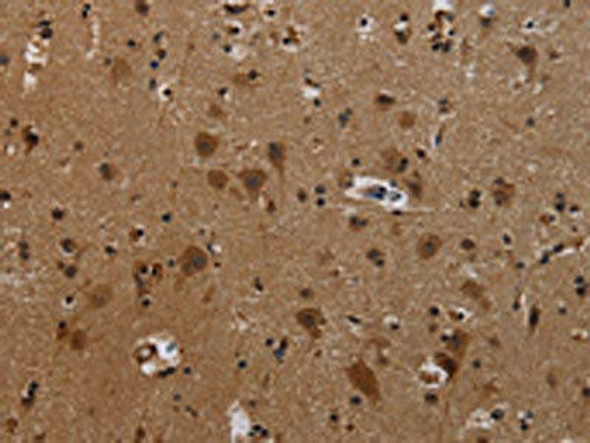 PCDHB11 Antibody (PACO20190)